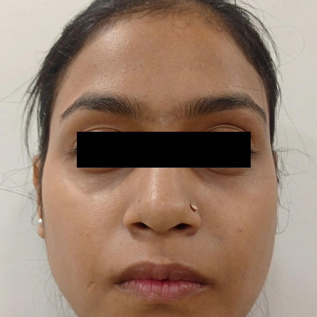 Glutathione IV Treatment - Berkowits Glutathione IV Treatment - Berkowits